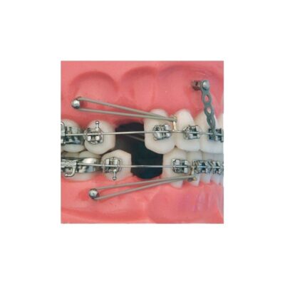 Mini Implantes Ortodonticos Autorroscantes - Leone - Imagen 2