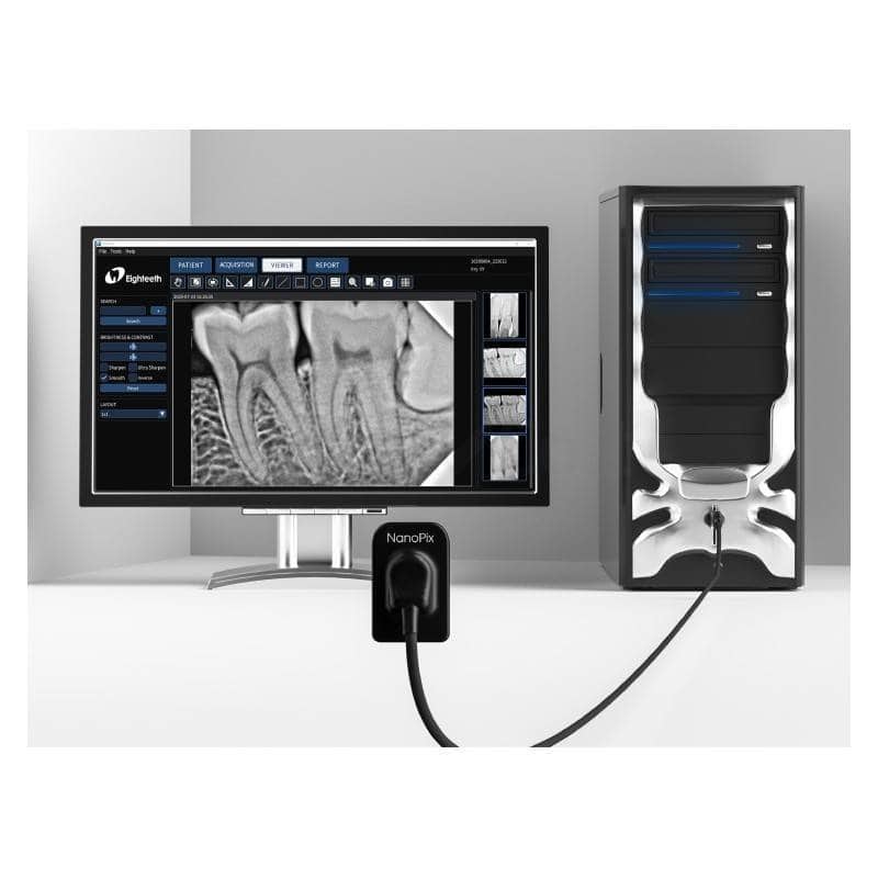 Alta resolución de escáner odontológico digital para diagnósticos precisos y diseño de prótesis personalizado en odontología.