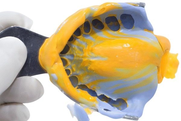 Es un modelo de dentadura en silicona con componentes personalizados para odontología.