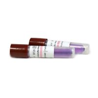 indicador-biologico-bt20-steam-vapor-bionova-caja-100-unidades Trompas de extracción de sangre para análisis clínicos, personalizadas, con etiquetas claras y de alta precisión, ideales para laboratorios y clínicas odontológicas, garantizando seguridad y comodidad.